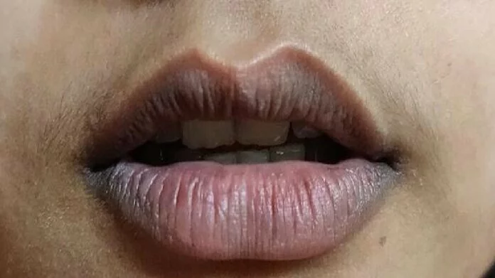 lip care tips: काले पड़ गए हैं आपके होंठ तो करें ये काम, हो जाएंगे गुलाबी और मुलायम