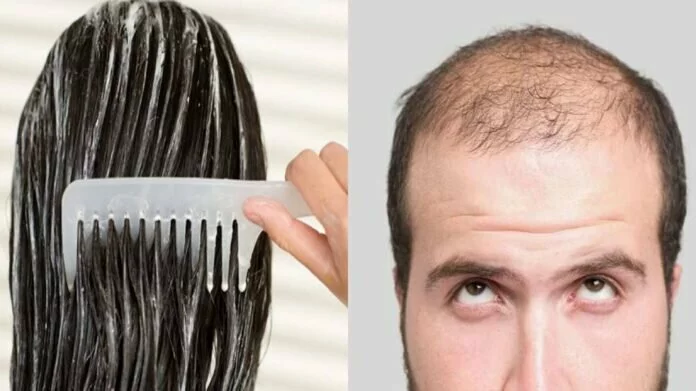 क्या हेयर कंडीशनर लगाने से Hair Fall होता है? जान लें सही तरीका, वरना हो जाएंगे गंजे