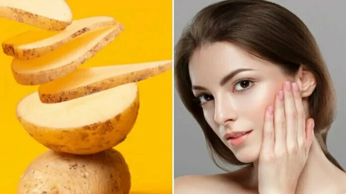 Benefits of potato face pack: इस तरह लगाएं आलू, दाग-धब्बे हो जाएंगे गायब, चमक उठेगा आपका चेहरा