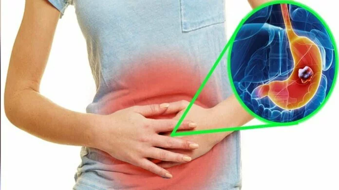 Strong Digestive System Tips: ये हैं वो 5 चीजें जो पाचन तंत्र को बना देती हैं मजबूत, जानिए इनके शानदार फायदे