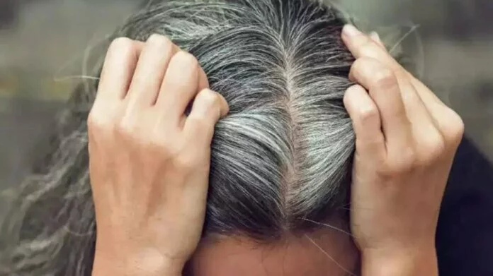 White Hair Problem solution: सफेद बालों को नेचुरल तरीके से काला कर देंगी ये चीजें