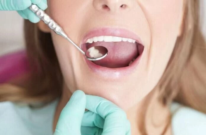 Dental Care Tips: दांतो को कैविटी से बचाने के लिए करें ये उपाय